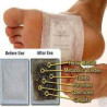 Kinoki Cleansing Detox Foot Pads 10 pcs